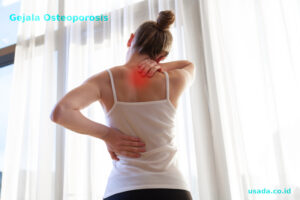 Read more about the article Ingin bebas Osteoporosis? Kenali Gejala Osteoporosis ini