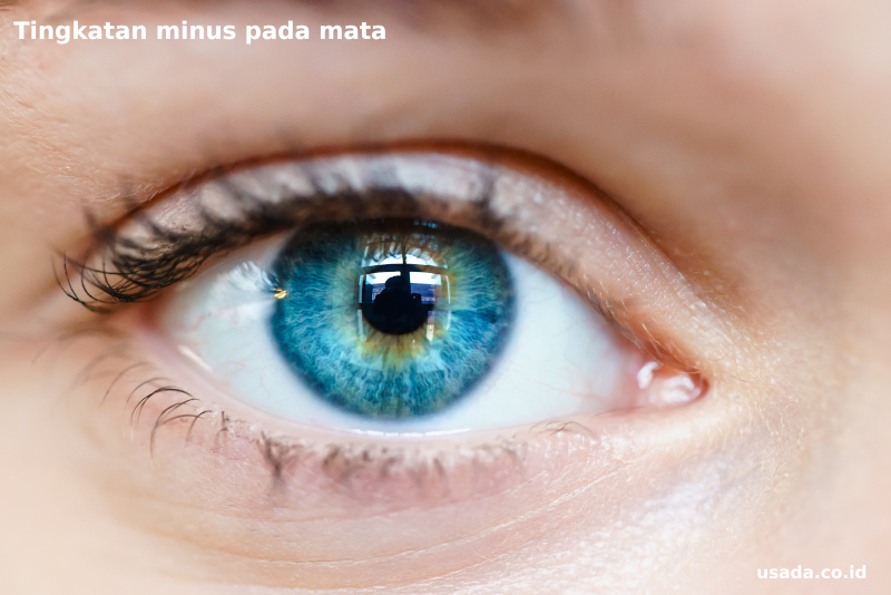 Mengenal Tingkatan Minus Mata dan Dampaknya bagi Penglihatan
