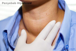 Read more about the article Apa Penyebab Hipotiroid yang Paling Umum?