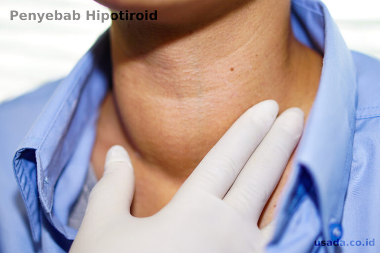 penyebab hipotiroid